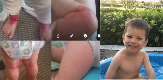 How going chemical-free helped this little boy
